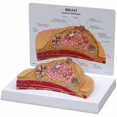 3B anatomisk modell av bryst