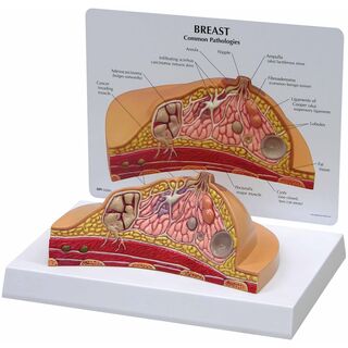 3B anatomisk modell av bryst