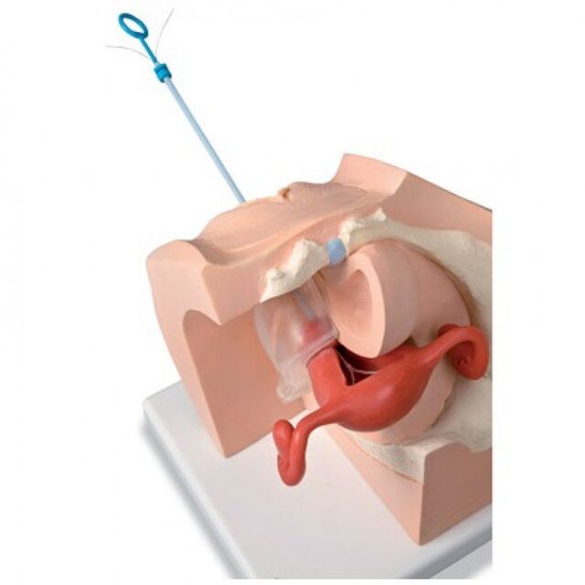 3B modell for prevensjon- og gynekologisk undervisning, kvinne 