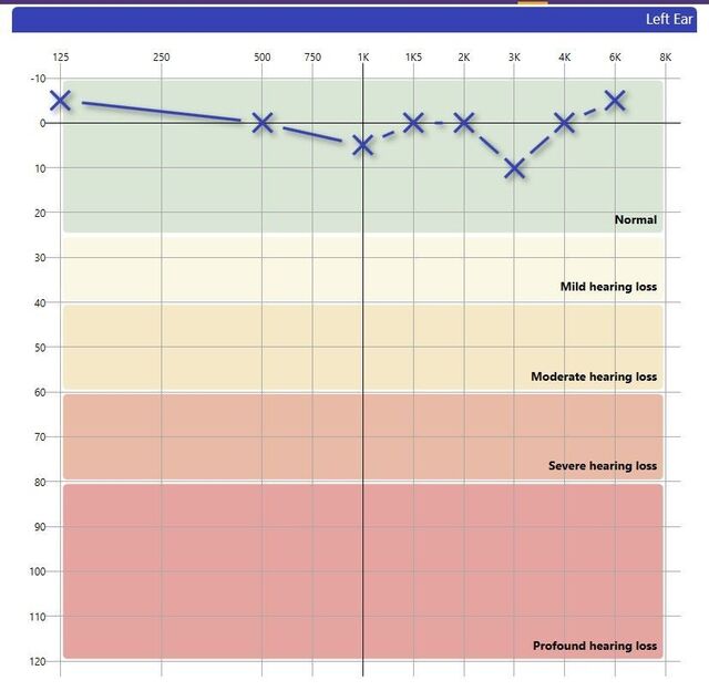 200805 Otosure PC audiometer inkl. audiocups øreklokker 