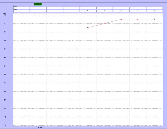 200805 Otosure PC audiometer inkl. audiocups øreklokker 
