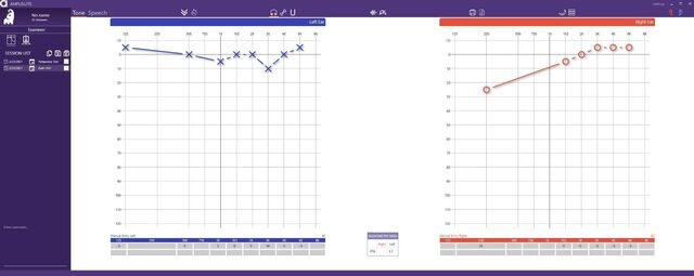 200805 Otosure PC audiometer inkl. audiocups øreklokker 